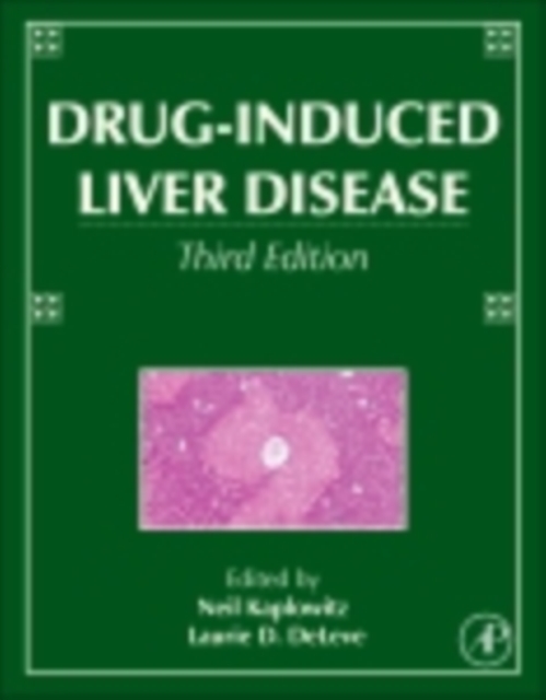 Drug-Induced Liver Disease, EPUB eBook