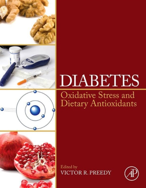 Diabetes : Oxidative Stress and Dietary Antioxidants, EPUB eBook