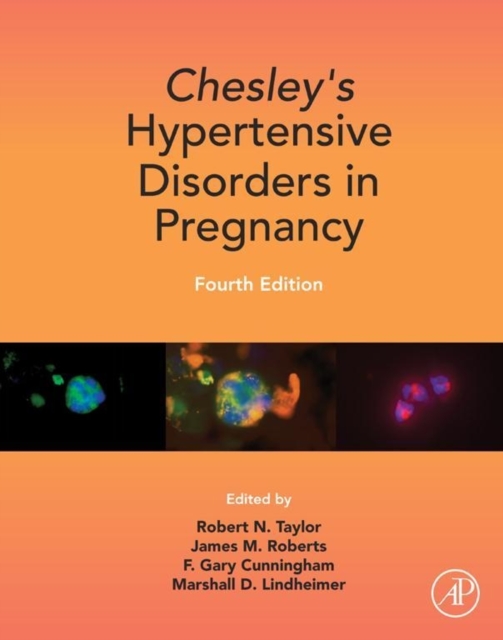 Chesley's Hypertensive Disorders in Pregnancy, EPUB eBook