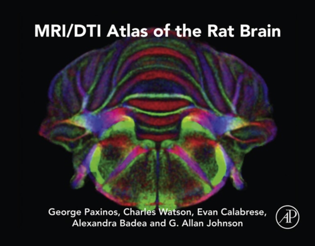MRI/DTI Atlas of the Rat Brain, EPUB eBook