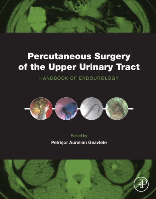 Percutaneous Surgery of the Upper Urinary Tract : Handbook of Endourology, EPUB eBook