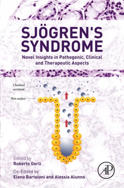 Sjogren's Syndrome : Novel Insights in Pathogenic, Clinical and Therapeutic Aspects, EPUB eBook