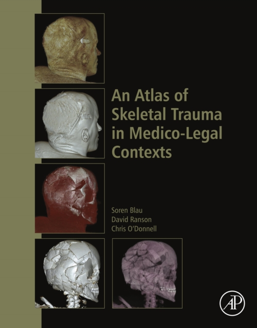 An Atlas of Skeletal Trauma in Medico-Legal Contexts, EPUB eBook