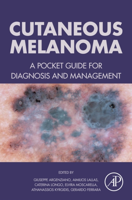 Cutaneous Melanoma : A Pocket Guide for Diagnosis and Management, EPUB eBook