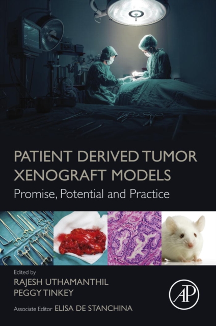Patient Derived Tumor Xenograft Models : Promise, Potential and Practice, EPUB eBook