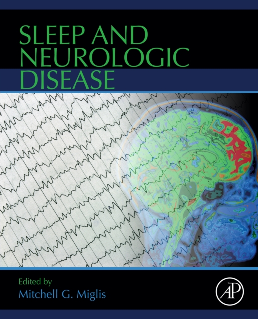 Sleep and Neurologic Disease, EPUB eBook