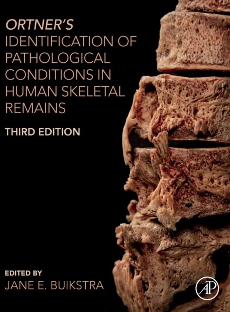 Ortner's Identification of Pathological Conditions in Human Skeletal Remains, Hardback Book