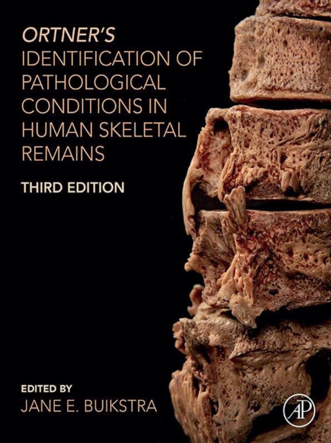 Ortner's Identification of Pathological Conditions in Human Skeletal Remains, EPUB eBook
