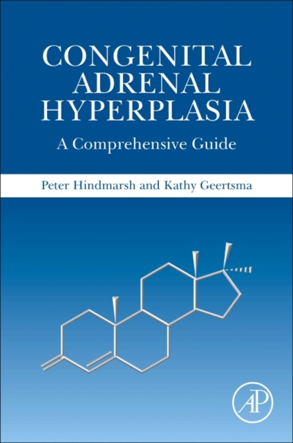 Congenital Adrenal Hyperplasia : A Comprehensive Guide, Paperback / softback Book