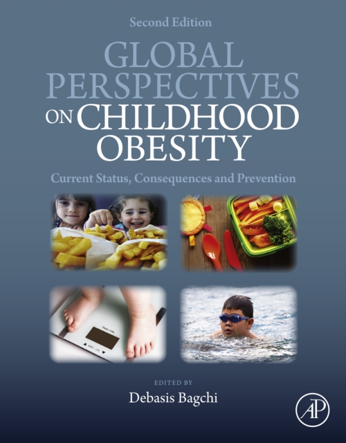Global Perspectives on Childhood Obesity : Current Status, Consequences and Prevention, EPUB eBook