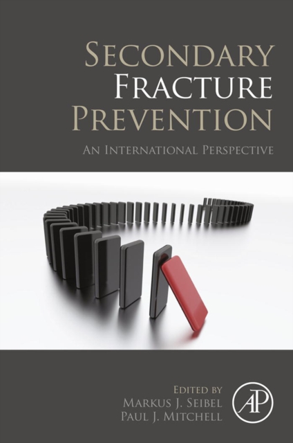 Secondary Fracture Prevention : An International Perspective, EPUB eBook