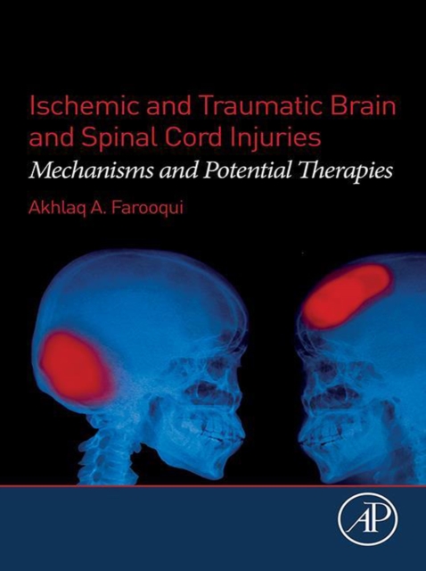 Ischemic and Traumatic Brain and Spinal Cord Injuries : Mechanisms and Potential Therapies, EPUB eBook