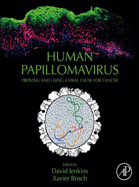 Human Papillomavirus : Proving and Using a Viral Cause for Cancer, EPUB eBook
