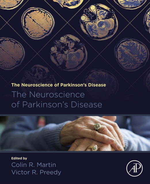 The Neuroscience of Parkinson's Disease, EPUB eBook