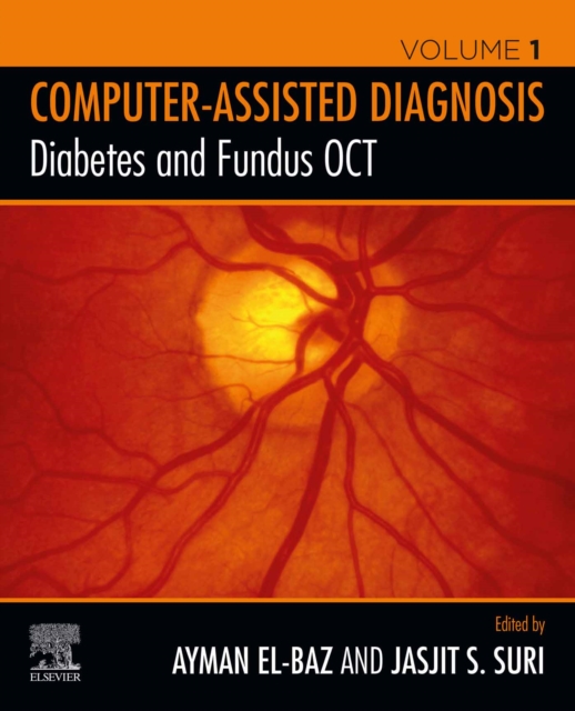Diabetes and Fundus OCT, EPUB eBook