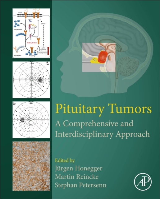 Pituitary Tumors : A Comprehensive and Interdisciplinary Approach, Hardback Book