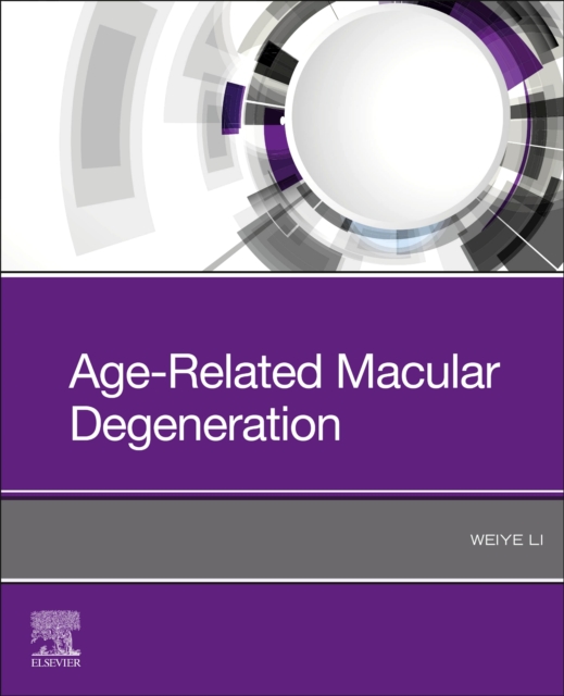 Age-Related Macular Degeneration, Paperback / softback Book