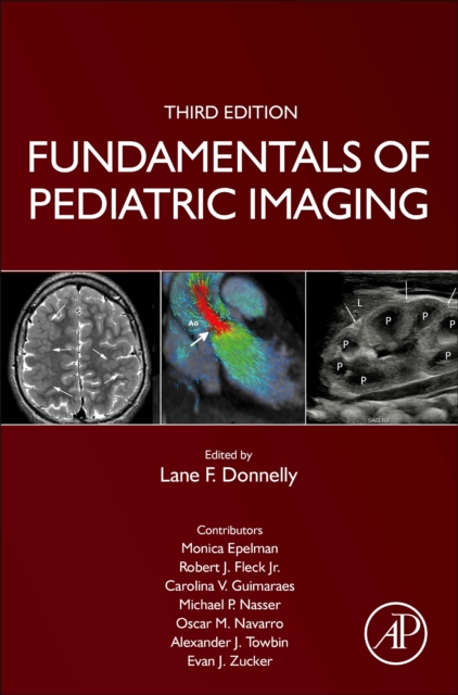 Fundamentals of Pediatric Imaging, Hardback Book