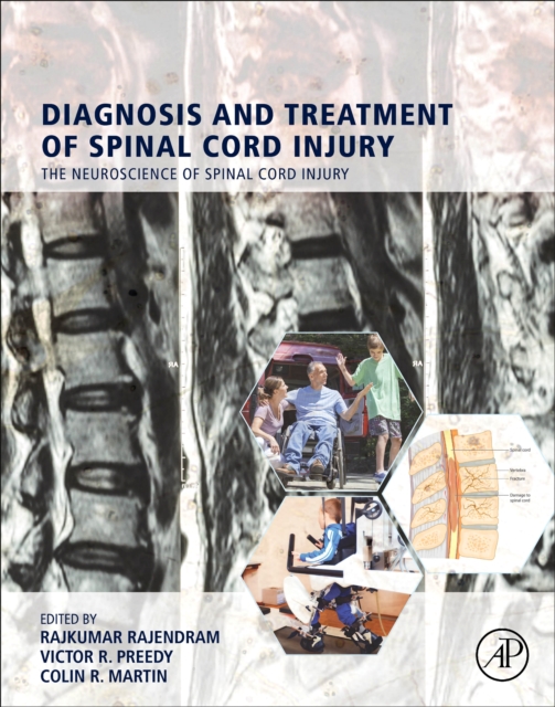Diagnosis and Treatment of Spinal Cord Injury, EPUB eBook
