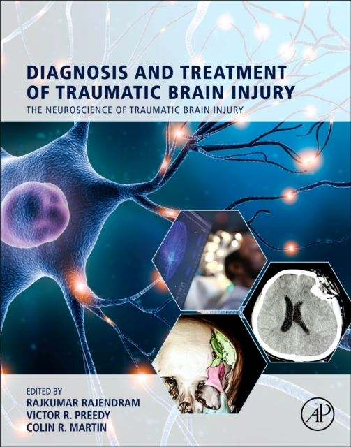 Diagnosis and Treatment of Traumatic Brain Injury, EPUB eBook
