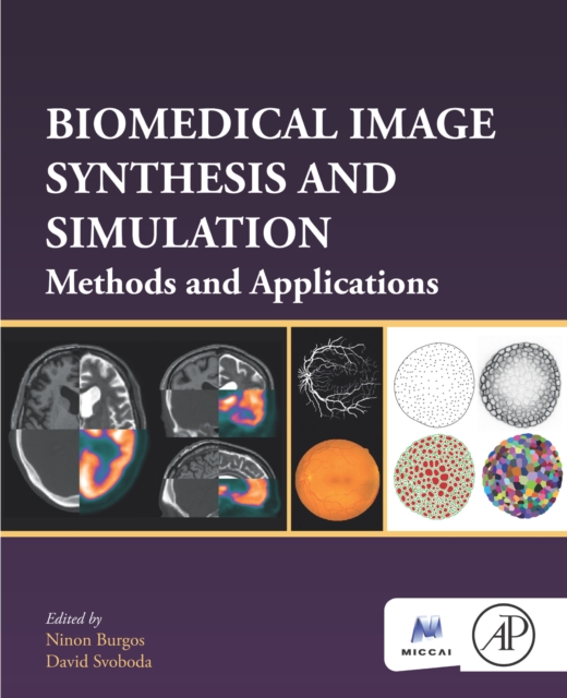 Biomedical Image Synthesis and Simulation : Methods and Applications, EPUB eBook