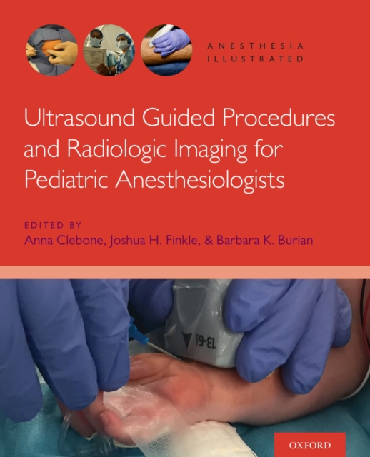 Ultrasound Guided Procedures and Radiologic Imaging for Pediatric Anesthesiologists, EPUB eBook