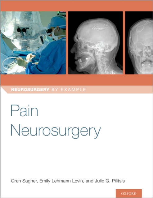 Pain Neurosurgery, PDF eBook