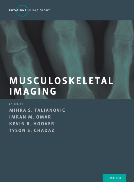 Musculoskeletal Imaging 2 Vol Set, EPUB eBook