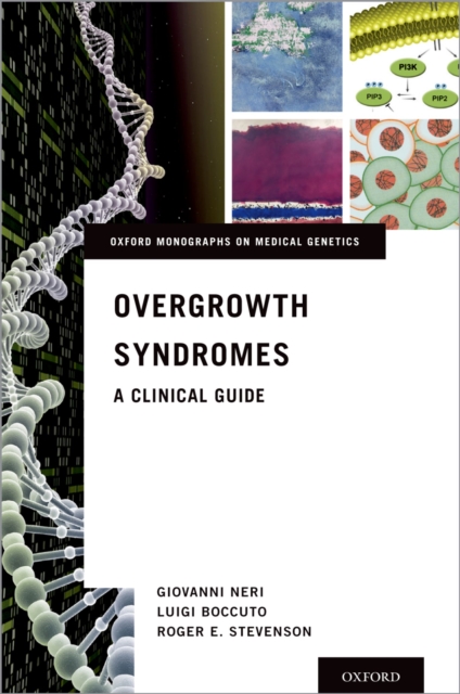 Overgrowth Syndromes : A Clinical Guide, PDF eBook