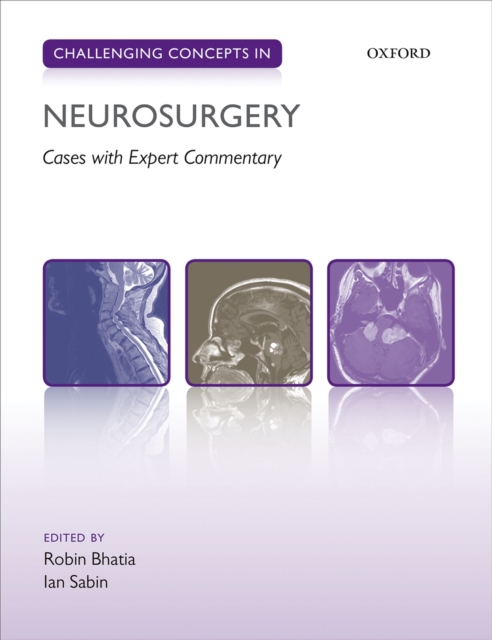 Challenging Concepts in Neurosurgery : Cases with Expert Commentary, PDF eBook