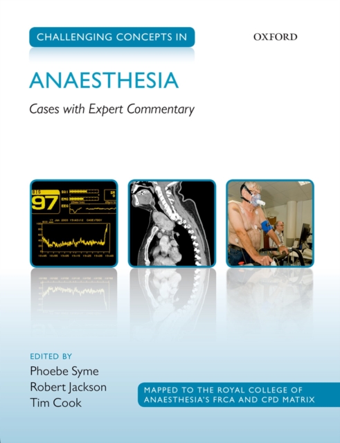 Challenging Concepts in Anaesthesia : Cases with Expert Commentary, EPUB eBook
