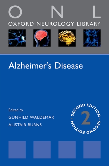 Alzheimer's Disease, PDF eBook