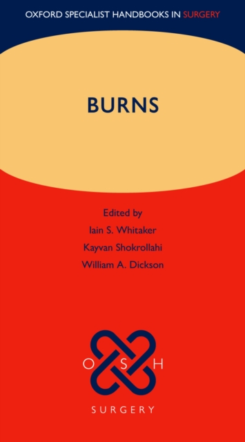 Burns, PDF eBook