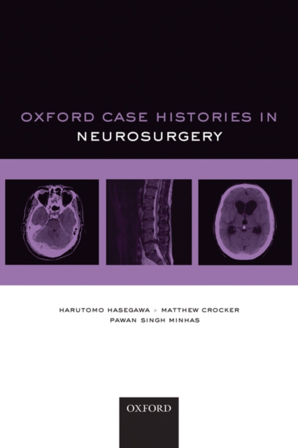 Oxford Case Histories in Neurosurgery, PDF eBook