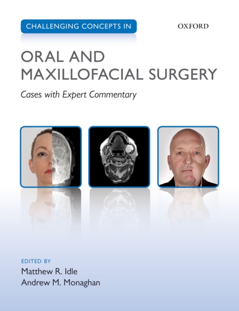 Challenging Concepts in Oral and Maxillofacial Surgery : Cases with Expert Commentary, EPUB eBook