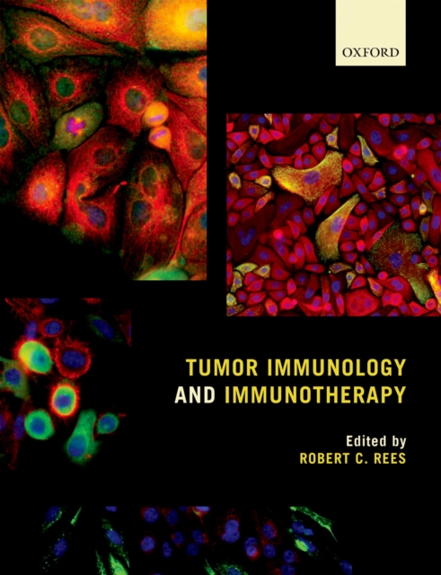 Tumor Immunology and Immunotherapy, PDF eBook