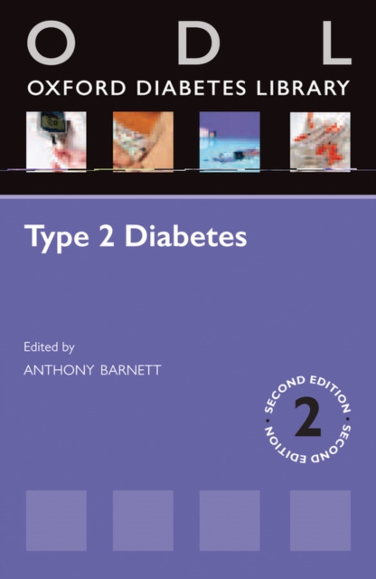 Type 2 Diabetes, PDF eBook