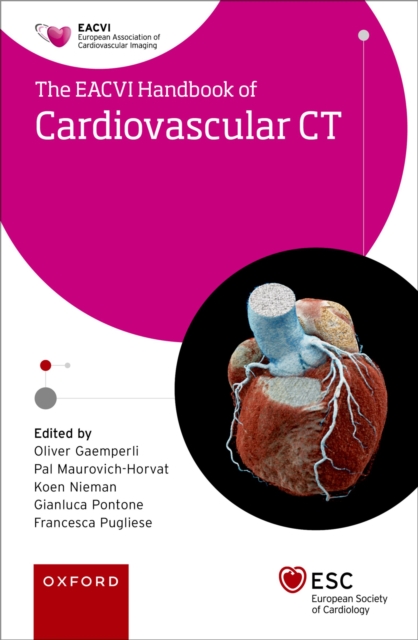 EACVI Handbook of Cardiovascular CT, EPUB eBook