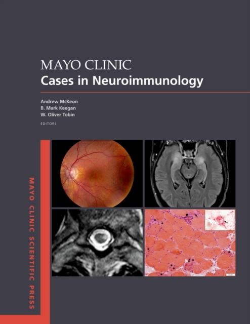 Mayo Clinic Cases in Neuroimmunology, PDF eBook
