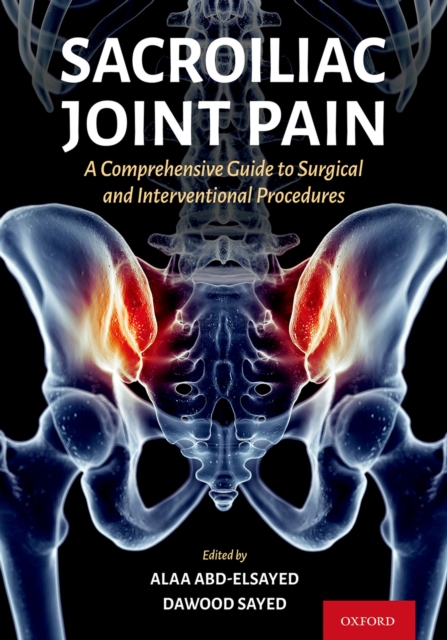 Sacroiliac Joint Pain : A Comprehensive Guide to Interventional and Surgical Procedures, PDF eBook