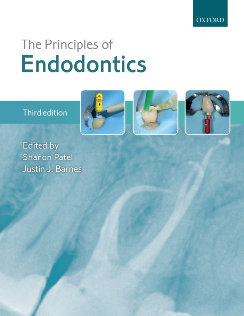 The Principles of Endodontics, Paperback / softback Book