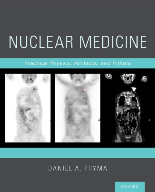 Nuclear Medicine : Practical Physics, Artifacts, and Pitfalls, PDF eBook
