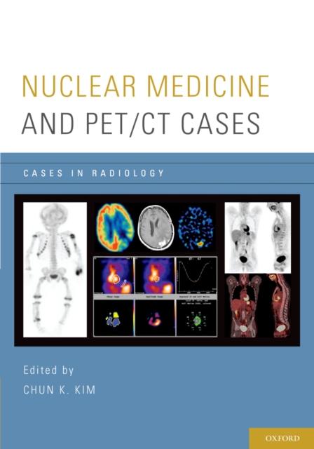 Nuclear Medicine and PET/CT Cases, PDF eBook