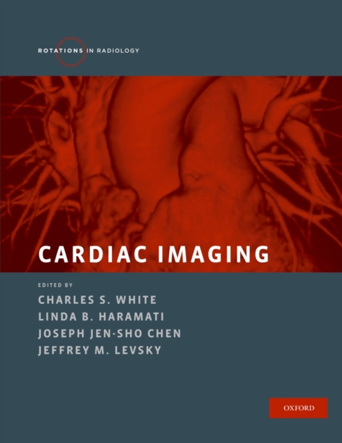 Cardiac Imaging, PDF eBook