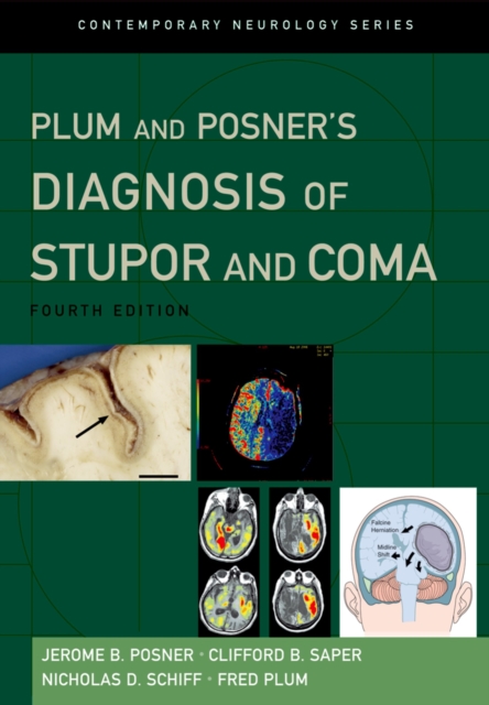 Plum and Posner's Diagnosis of Stupor and Coma, EPUB eBook