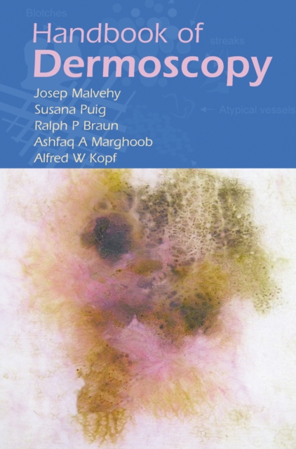 Handbook of Dermoscopy, PDF eBook