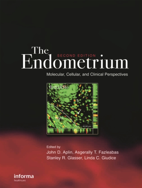 The Endometrium : Molecular, Cellular and Clinical Perspectives, Second Edition, PDF eBook