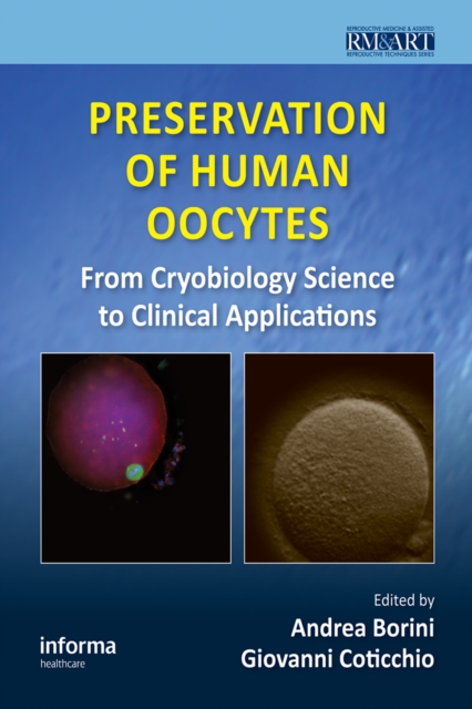 Preservation of Human Oocytes : From Cryobiology Science to Clinical Applications, PDF eBook