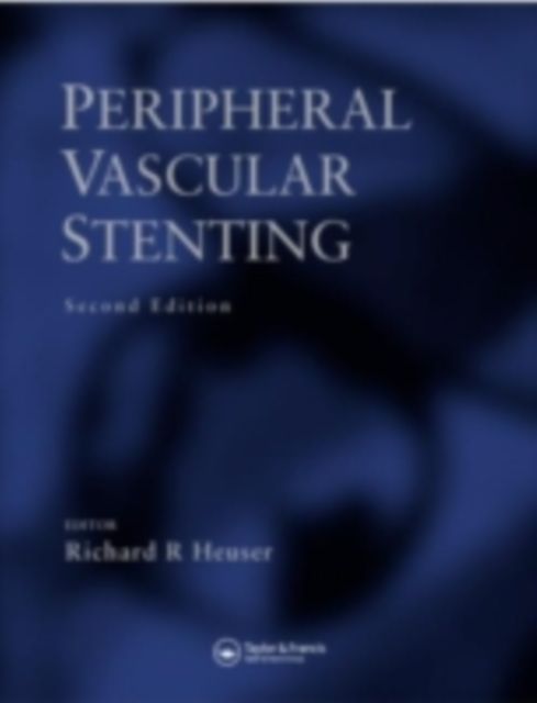 Peripheral Vascular Stenting, PDF eBook