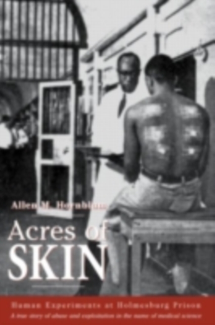 Acres of Skin : Human Experiments at Holmesburg Prison, PDF eBook